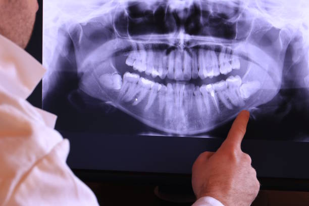 Best Pediatric Emergency Dentist in Harlan, IA