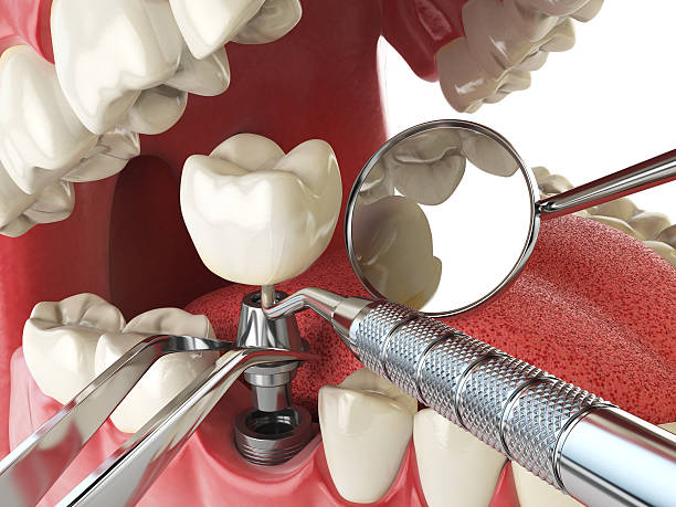 Best Emergency Broken Tooth Repair in Harlan, IA
